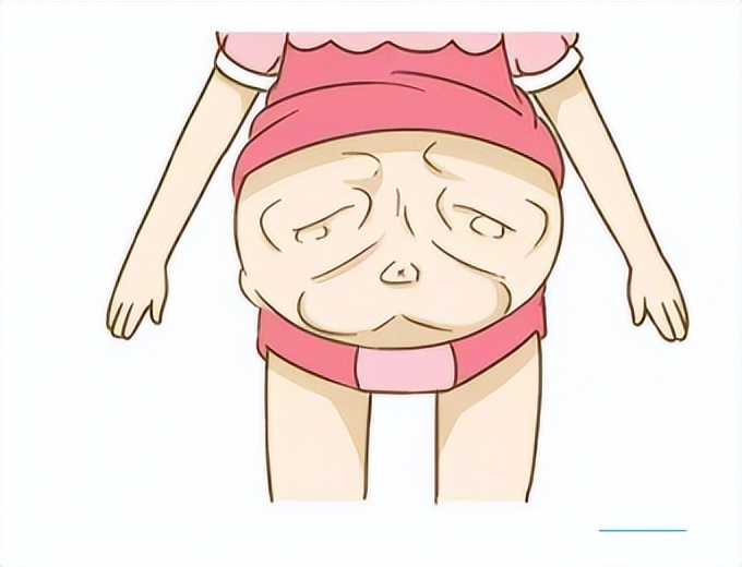 腹部松弛的女性是生过小孩的吗,腹壁松弛是因为肚子太大吗