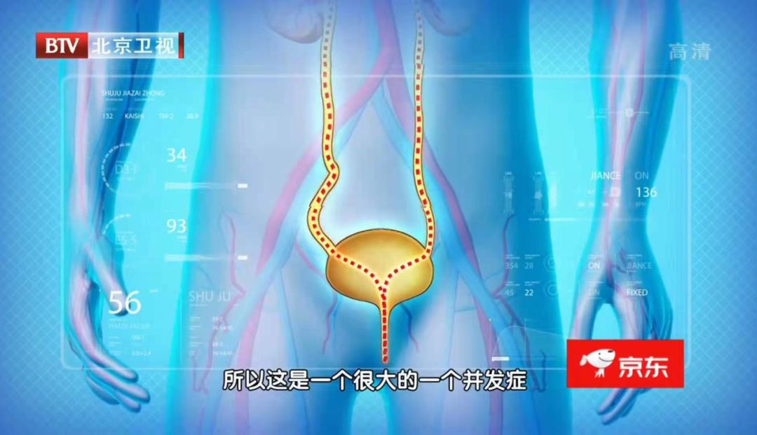 起夜频繁是得了夜尿症吗,经常起夜夜尿多是什么原因