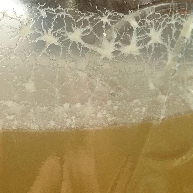 醋里面长出了一团肥肉,醋里长的肥肉