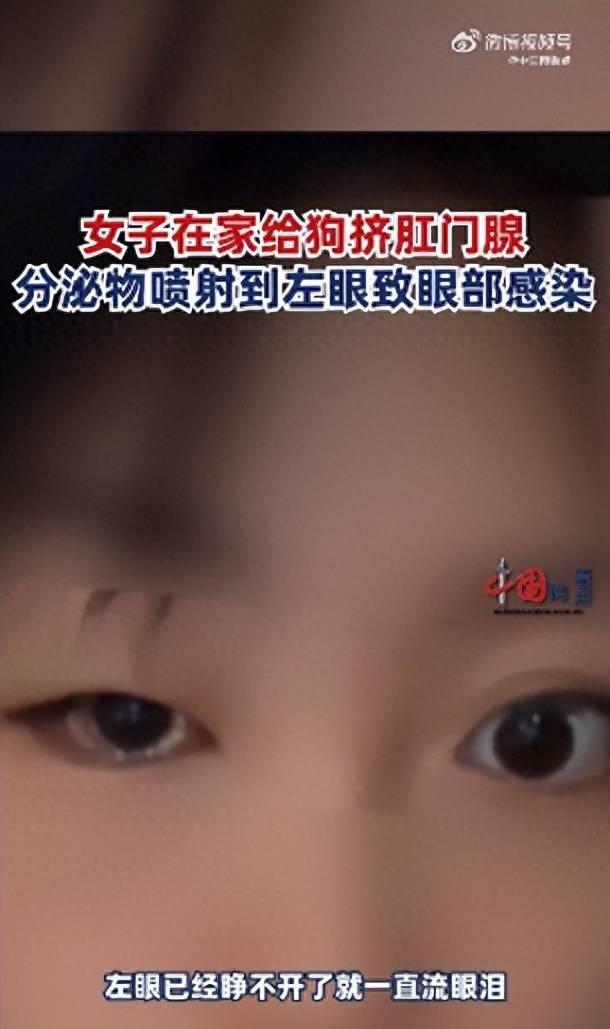 女子为宠物挤肛门腺，不慎致异物喷射眼睛，医生开消炎药治疗