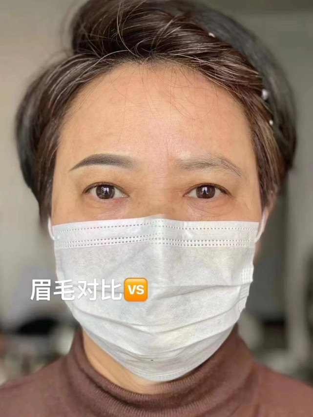 满大街整容后遗症,满大街都是韩式纹眉