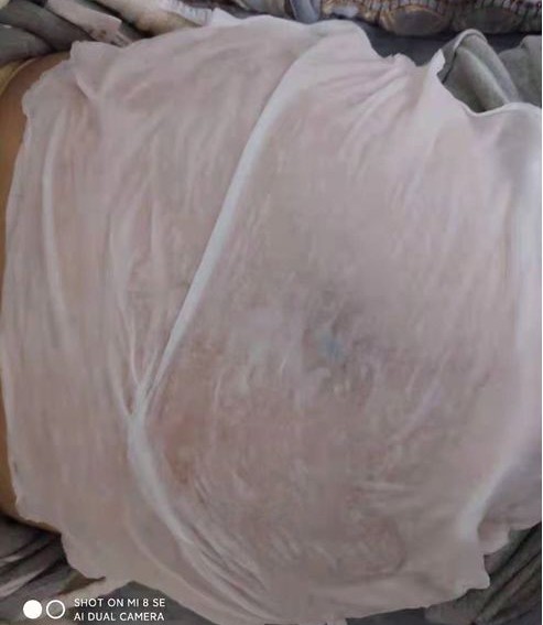 怀孕期间长了妊娠纹怎么补救,怀孕长妊娠纹怎么消除