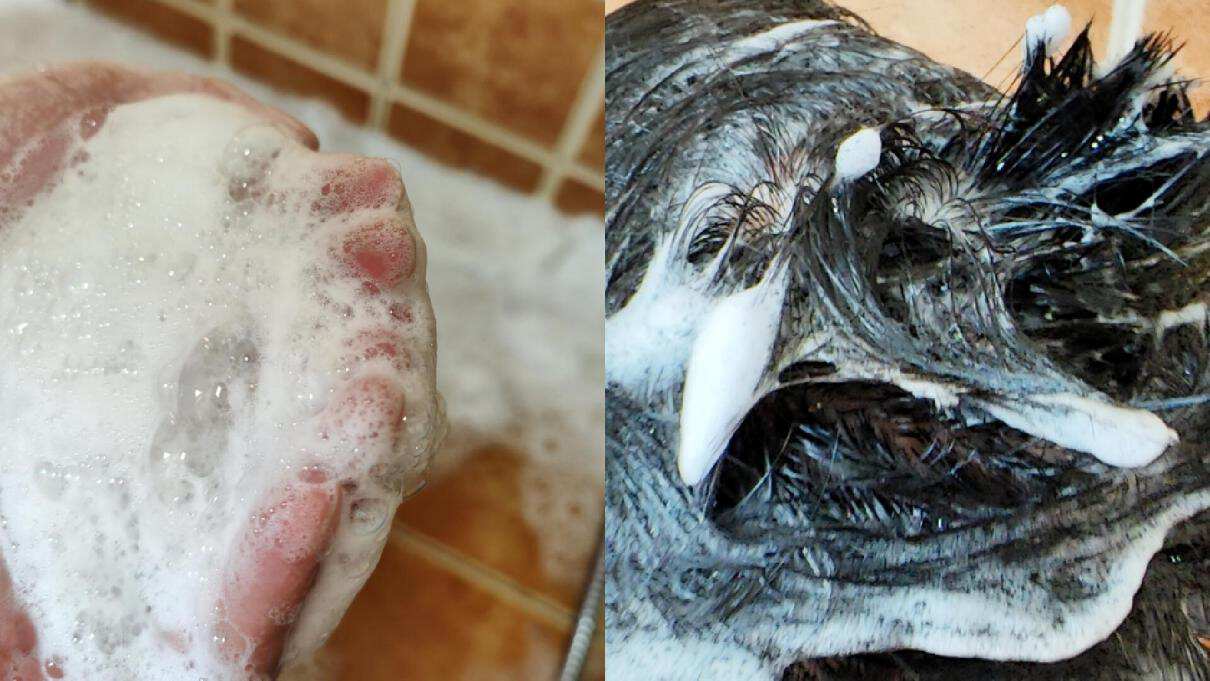 去头皮屑防掉发的洗发水推荐,脱发痒用哪一款洗发水比较好