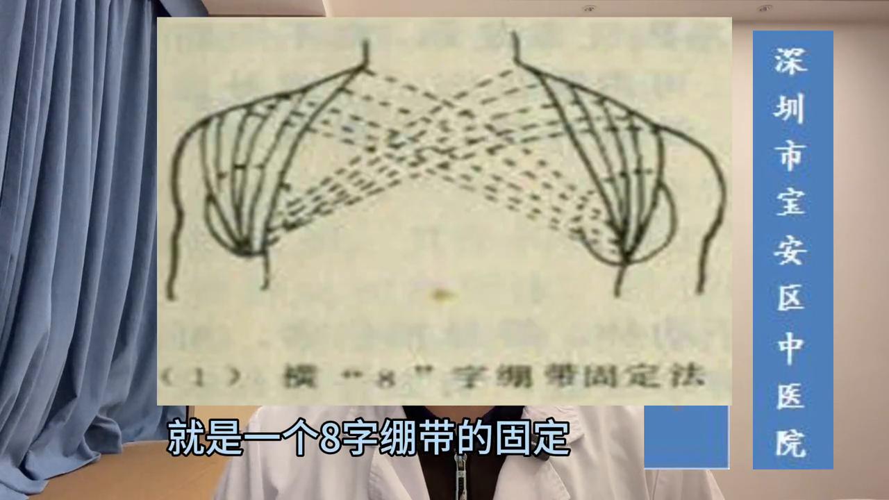 锁骨骨折保守治疗绷带多久去掉,锁骨骨折保守治疗后怎么锻炼视频