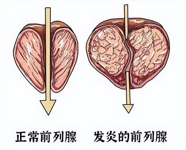 一紧张就想上厕所，是怎么回事？请收下这篇科普