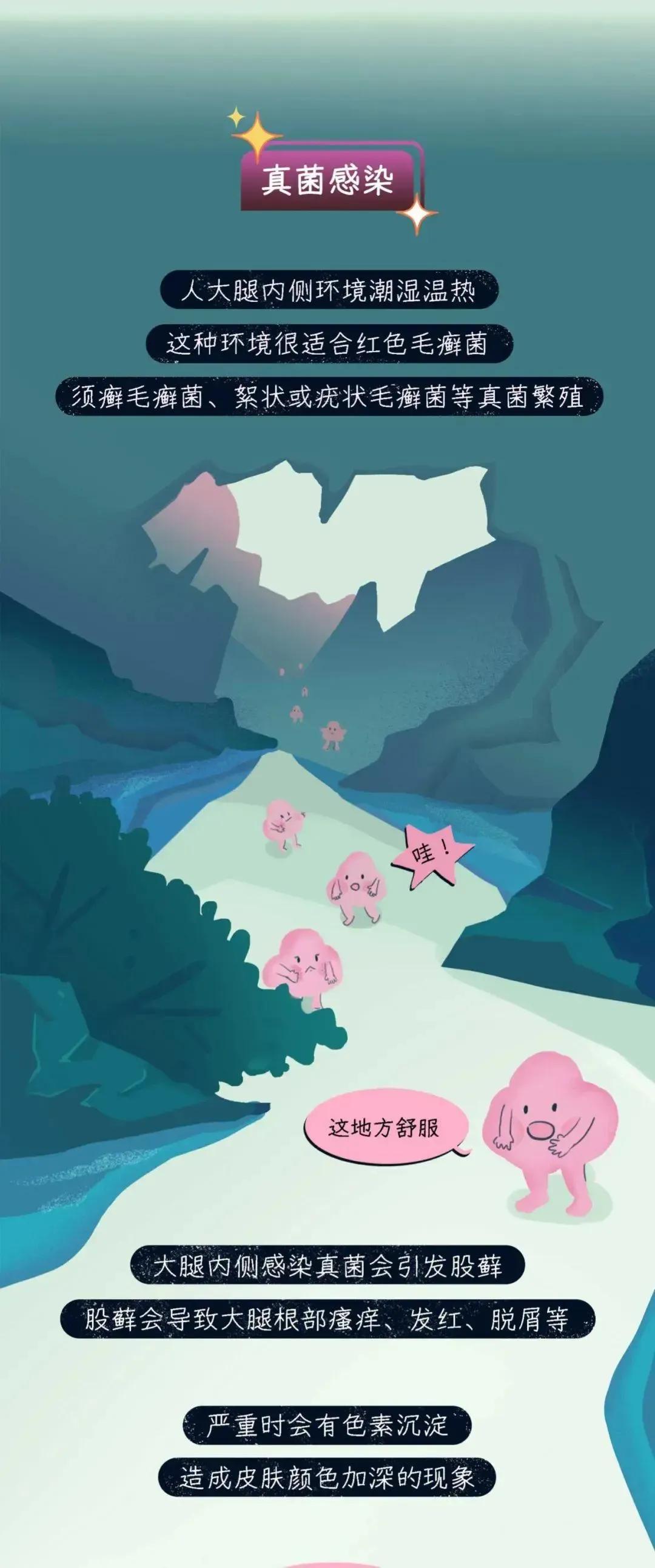 大腿两侧皮肤变黑是为什么呀,为啥女孩子大腿会淤黑