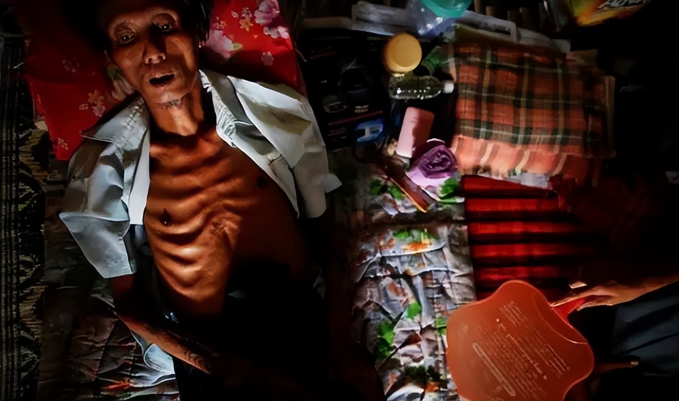 缅甸艾滋病,缅甸有艾滋病免费治疗的药吗