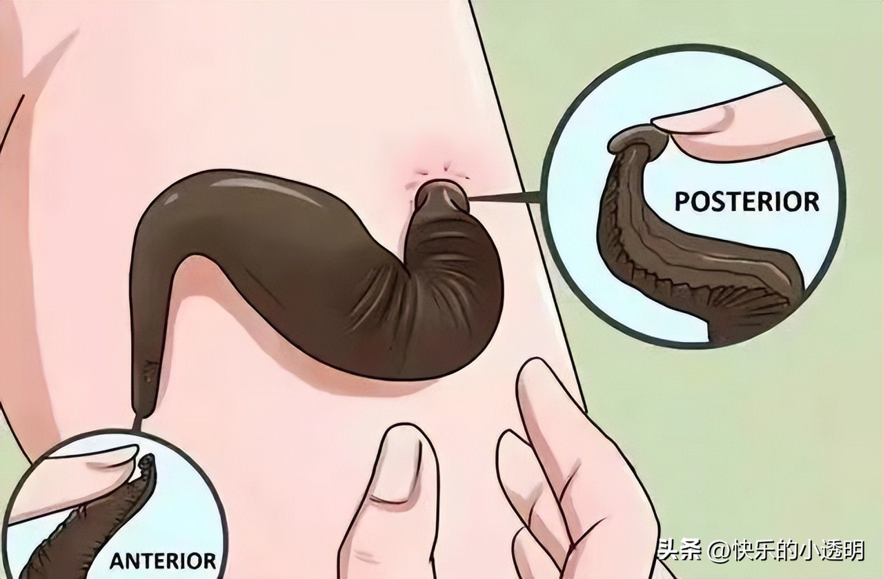 蚂蟥用活的吸血有什么危害,蚂蟥吃到肚子里有什么危险