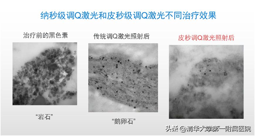 皮秒激光美白嫩肤祛斑紧肤,一起美起来