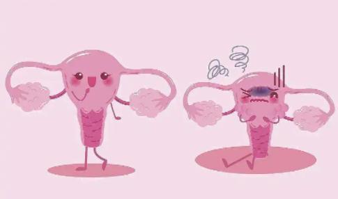 女裤发黄是有妇科病吗,妇科病引起面色发黄