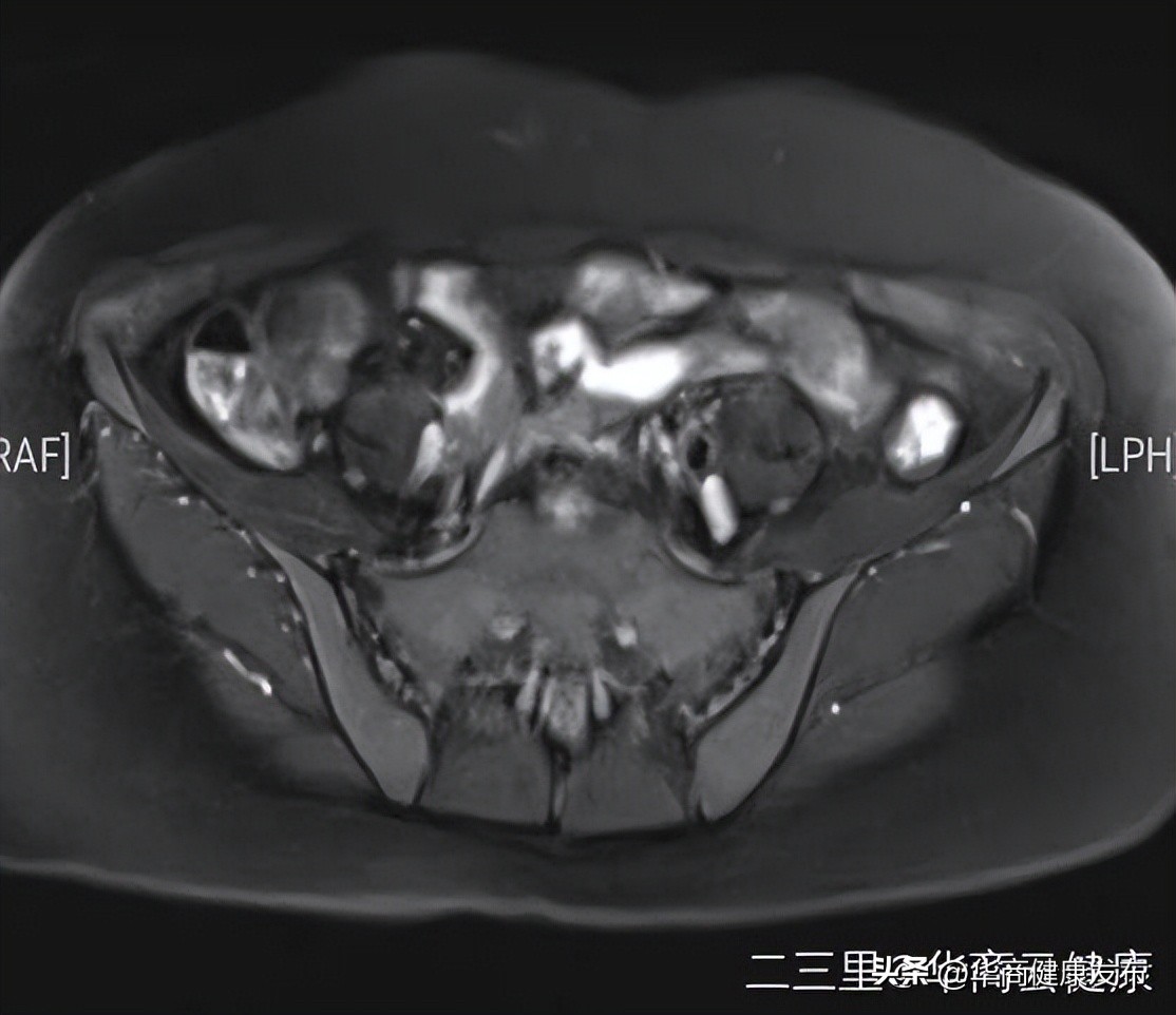 全国肿瘤宣传周癌症防治核心要点,肿瘤防治宣传周公益科普短视频