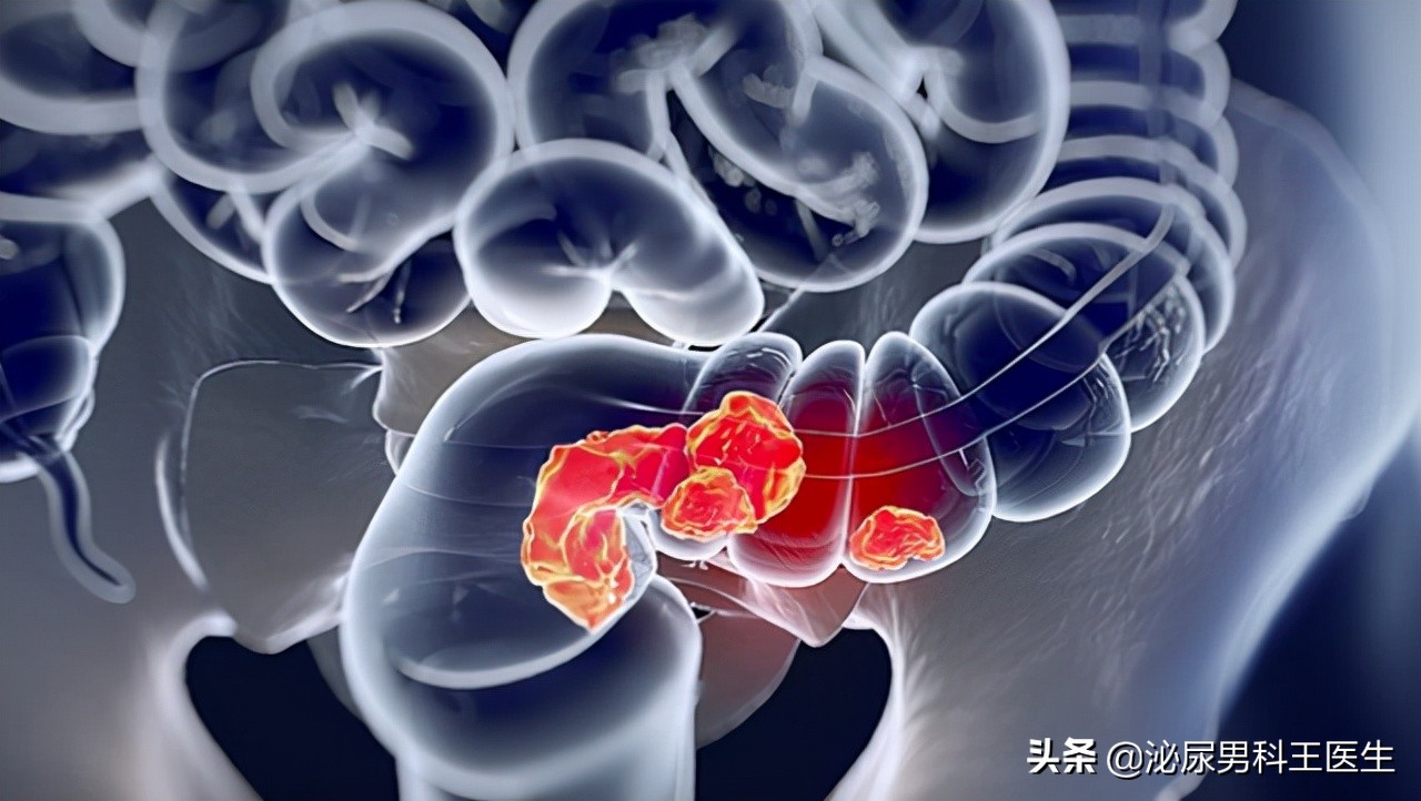 肛门潮湿发痒且有分泌物怎么处理,肛门潮湿发痒是什么病