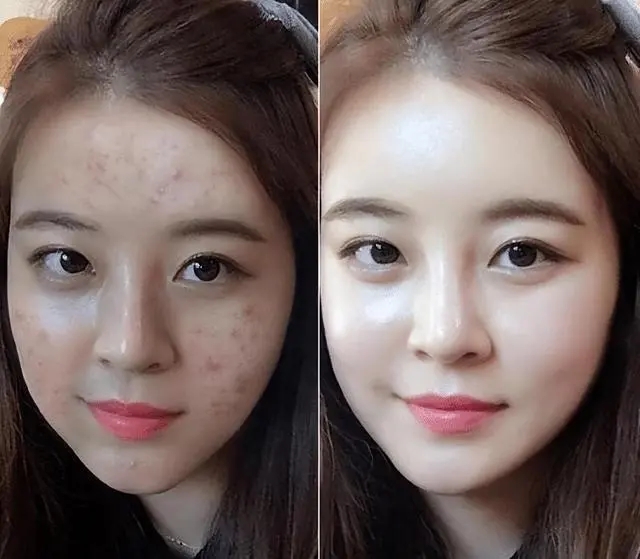 美白淡斑面霜推荐,美白淡斑紧致面霜推荐