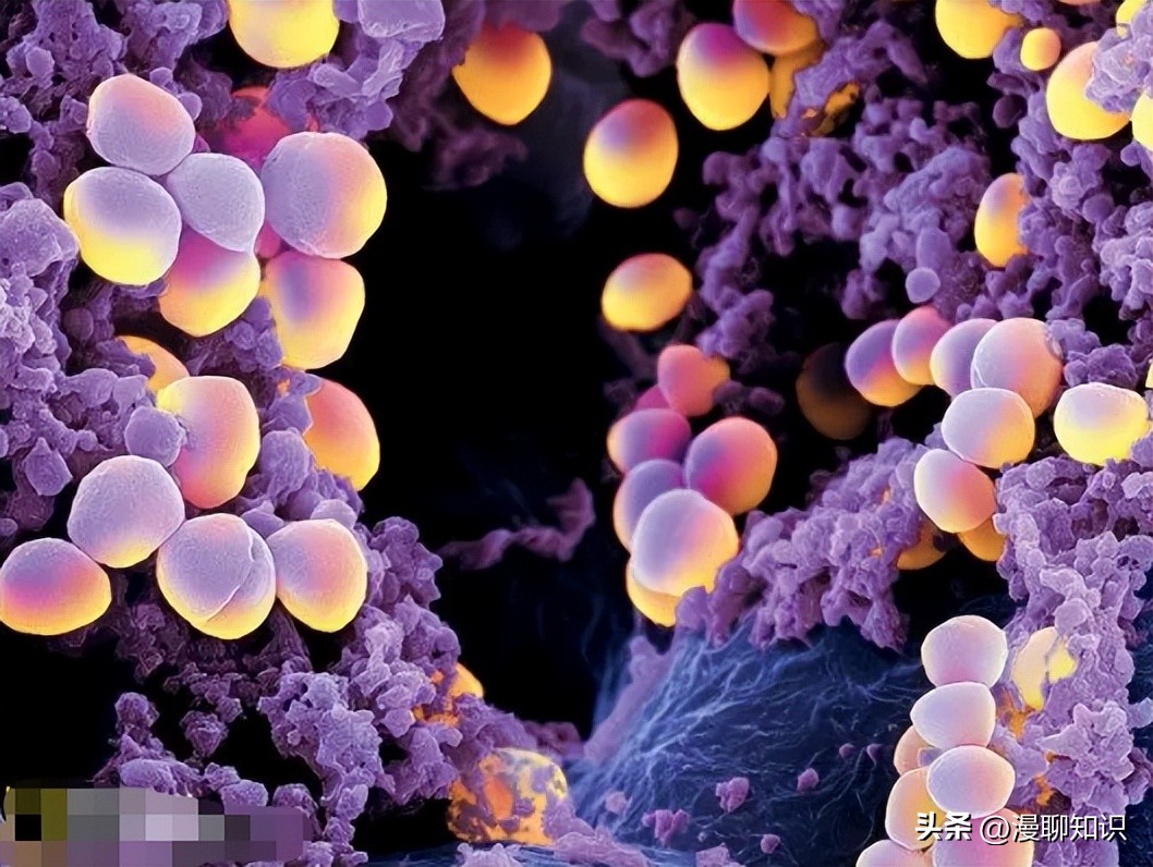 牦牛是高山地区牛的独特品种，肉质鲜嫩，但却饱受葡萄球菌的侵害