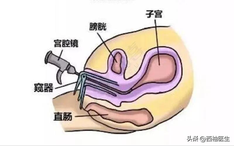宫腔镜手术前需要做哪些检查项目,做宫腔镜检查需要打麻醉药吗