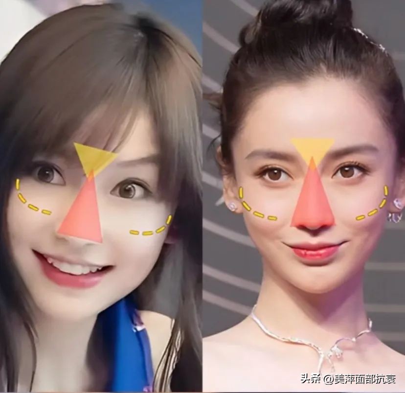 中庭长怎么避免显老,中庭长怎么改善