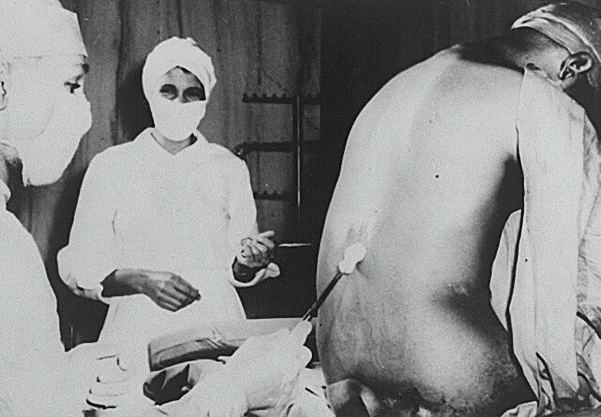 放任梅毒传染，观察患者如何死去：这项黑暗的实验持续了40年