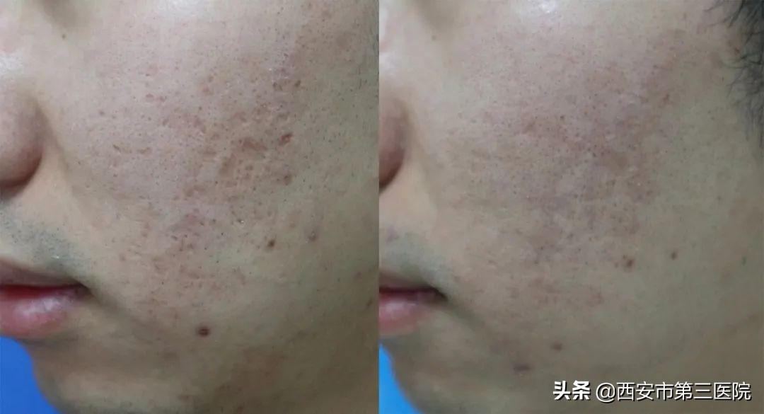 变美从这里开始英文,变美从皮肤开始