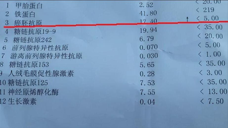 癌胚抗原升高多少可以显示癌症,癌症病人癌胚抗原升高说明什么