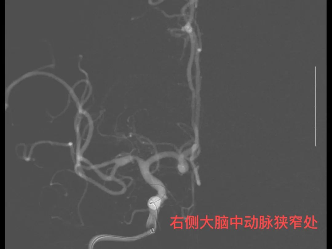 济南市莱芜人民医院口镇分院,山东打通生命通道济南