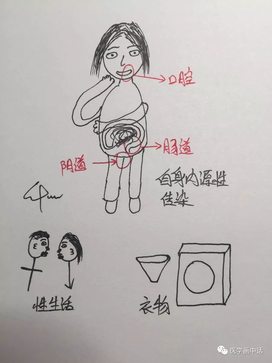 霉菌外阴炎瘙痒用什么药效果好,外阴瘙痒是霉菌炎用什么药最好