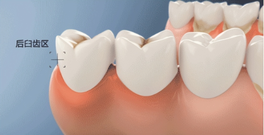 全网测评最好的儿童牙刷,2023儿童电动牙刷测评排行榜