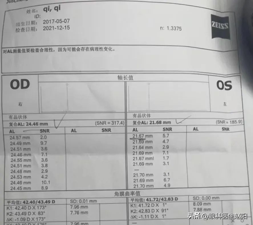 孩子近视怎么办切忌盲目配镜,孩子近视了怎样劝导她不要焦虑