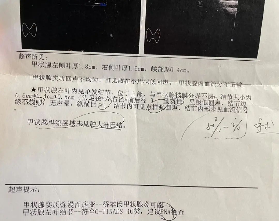 两个女儿相继确诊癌症,一个月内两个女儿接连确诊癌症