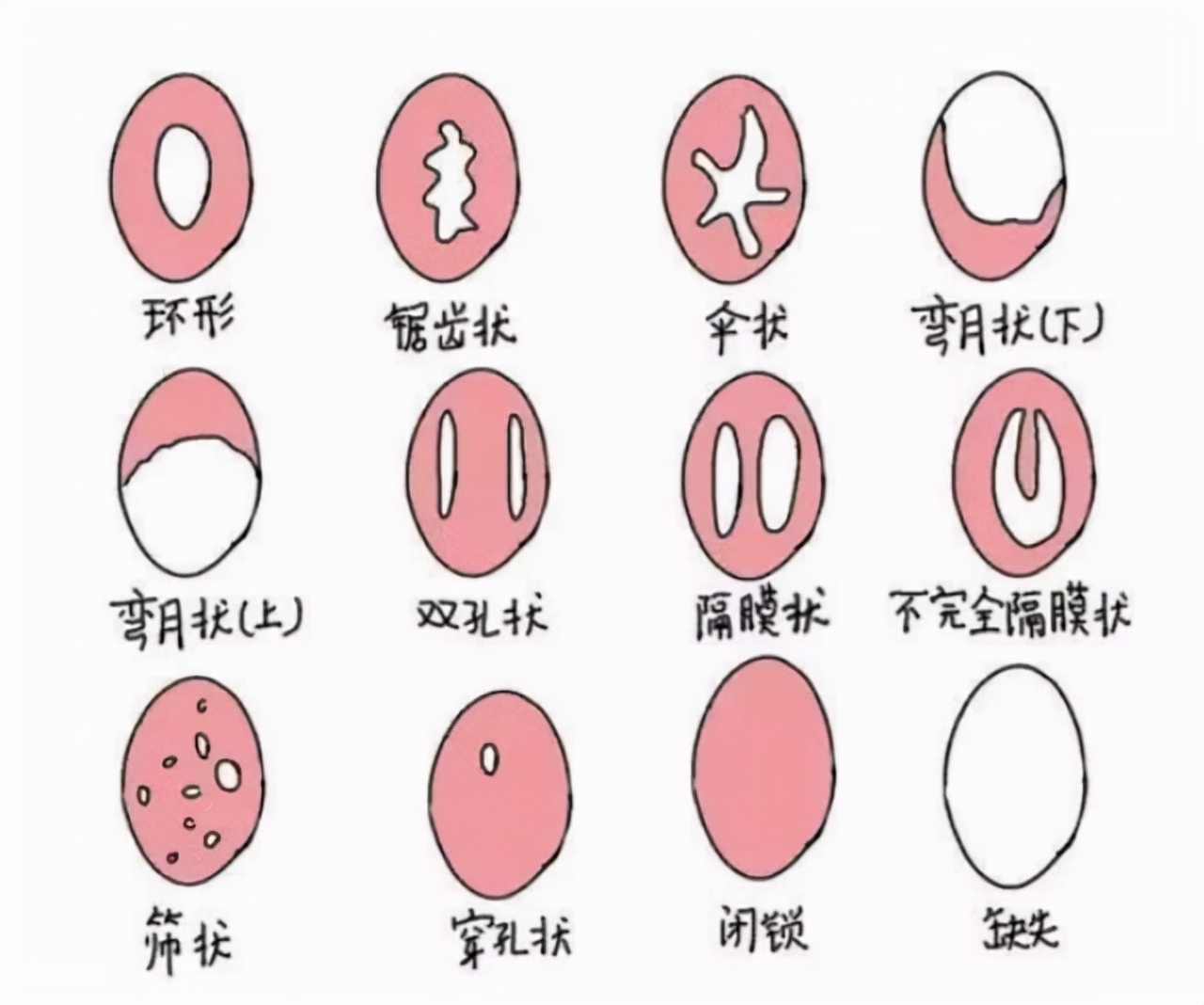 处女能够检查出来吗？那层膜到底有何用？女孩们一定要保护好自己