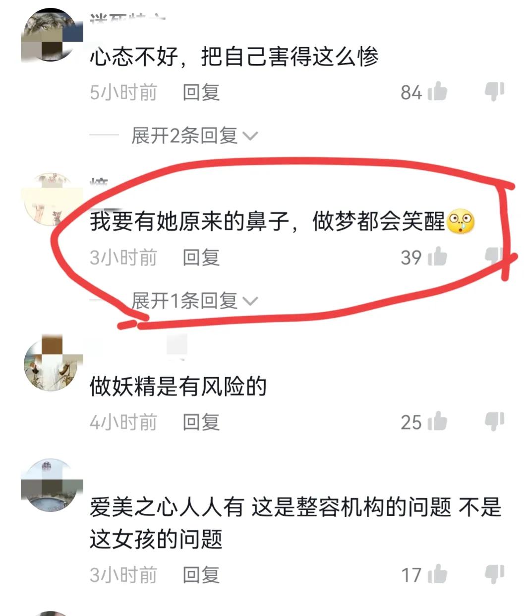 猪鼻子整容,女子花四万整容结果嘴巴歪了