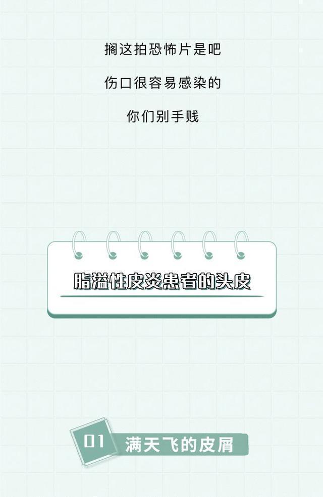 头皮上白色的颗粒是什么问题,头皮屑多是什么原因漫画