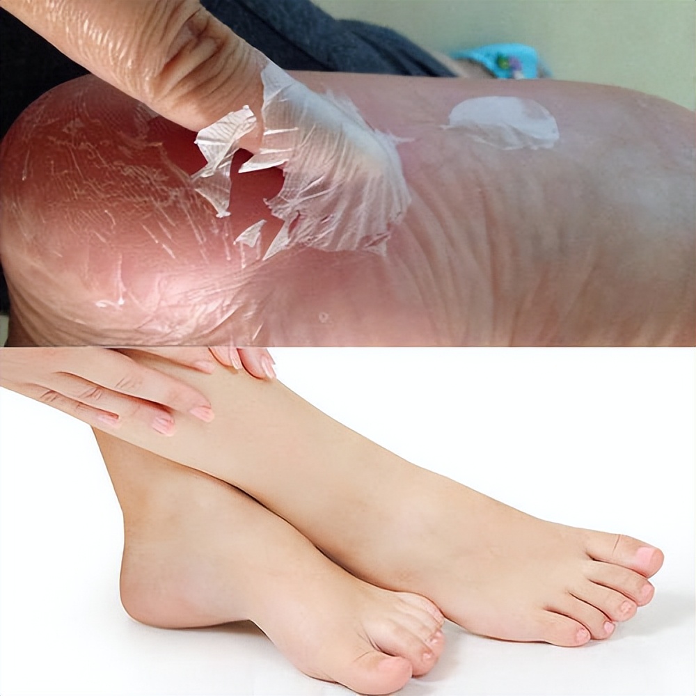 皮肤粗糙暗沉毛孔粗大怎么改善,改善皮肤毛孔粗大变白的洗面奶