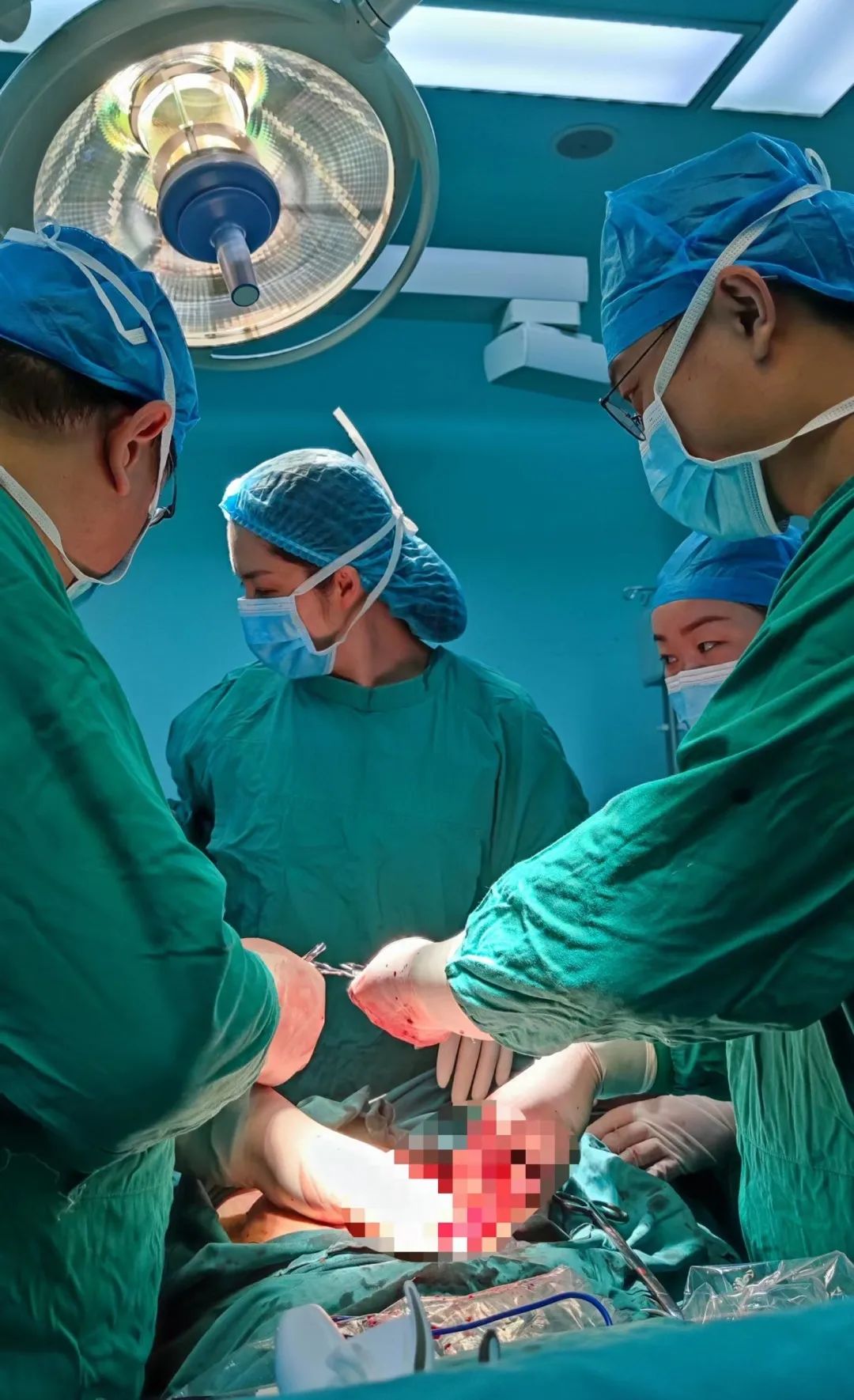 卵巢癌超根治术，为晚期患者带去生的希望