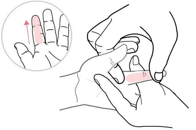 小孩咳嗽反复发烧有什么好方法,孩子咳嗽反复发烧怎么办最有效