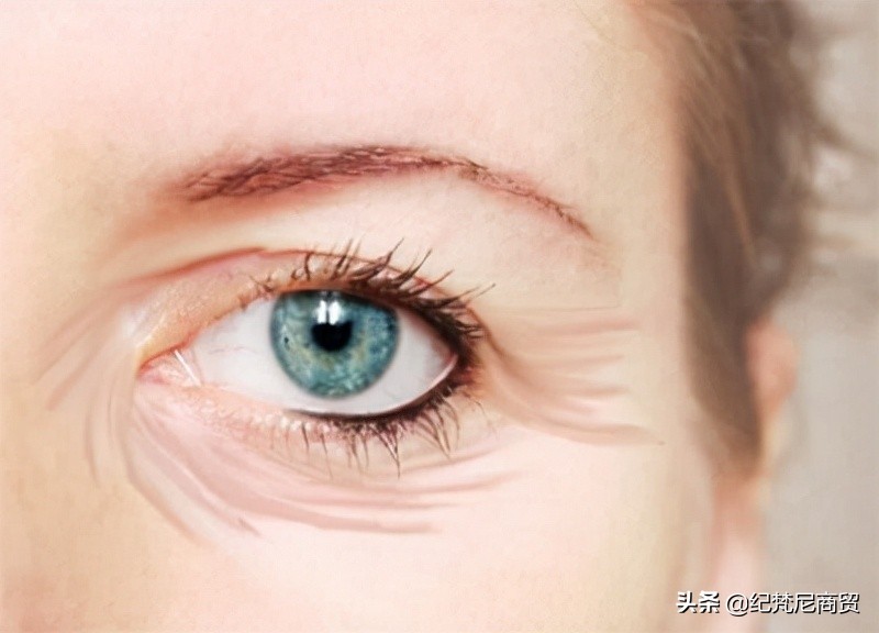 让眼睛周围皱纹变平整的技巧,为什么眼睛周围起皱纹