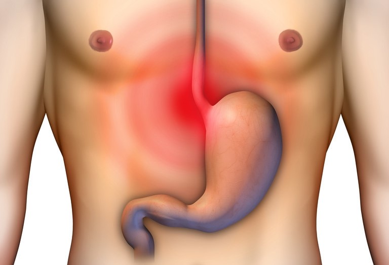 广场舞导致肠梗阻,跳广场舞小肚子疼怎么回事