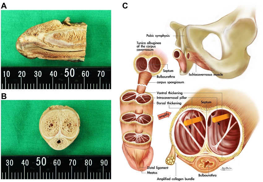 医生提醒：七夕可以过，但是要小心安全，比如别把丁丁弄断了