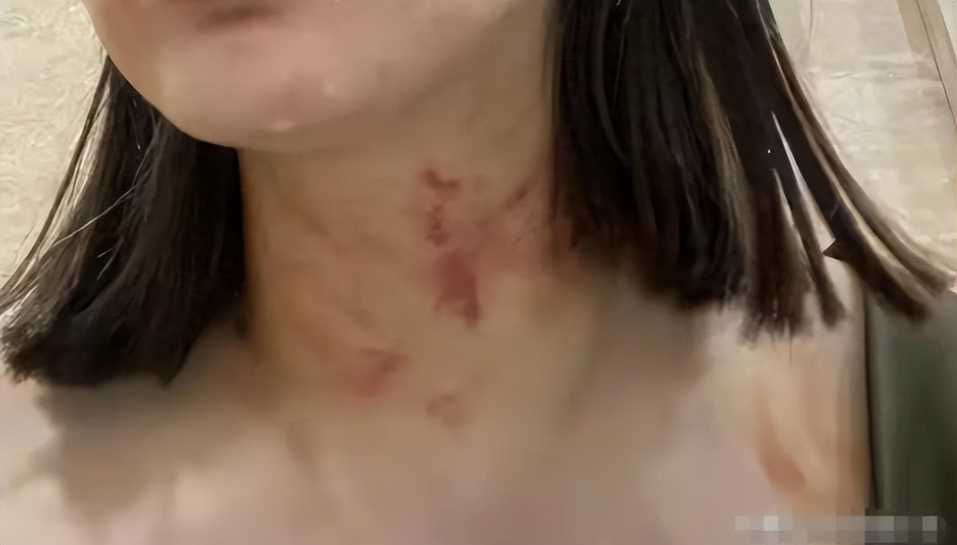 闹大了！电梯内狗尾巴扫腿，23岁女子在打斗中被扯下衣服！真惨烈