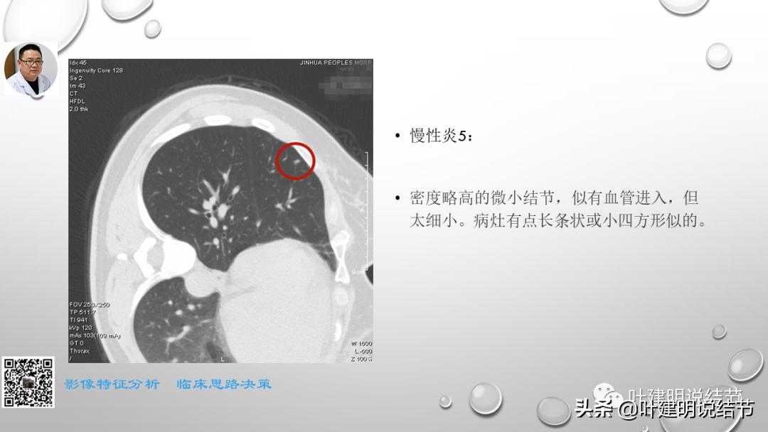 在《一脉阳光》呼吸影像诊断专题培训班上的讲课PPT（第一部分）