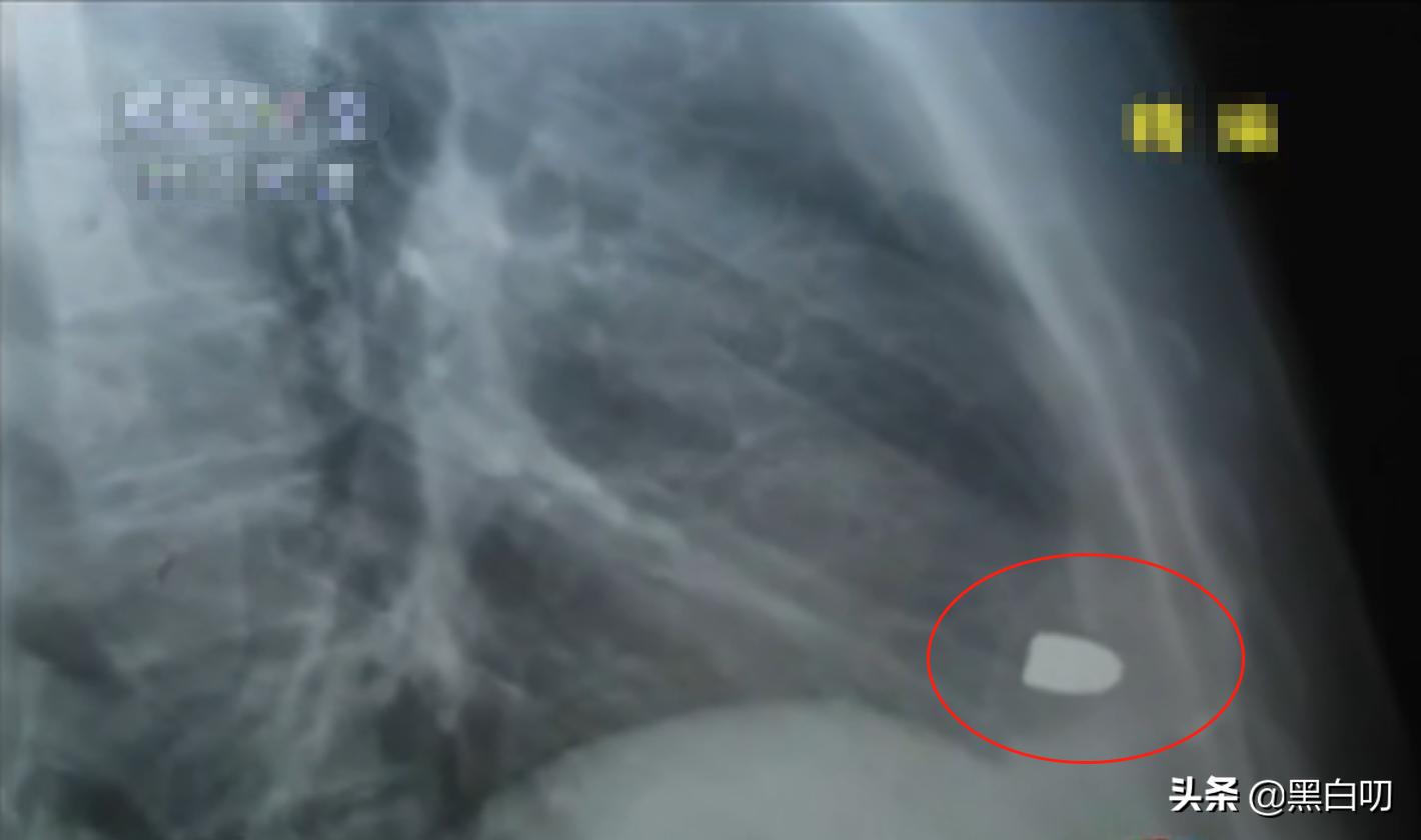 男子心脏不舒服不去医院,心脏不舒服去医院怎样查