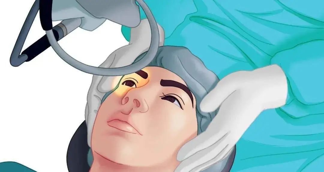 白内障久拖不治成弱视,白内障一直不做手术有什么后果