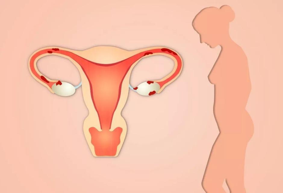 内裤上有分泌物什么原因,为什么内裤总是有分泌物