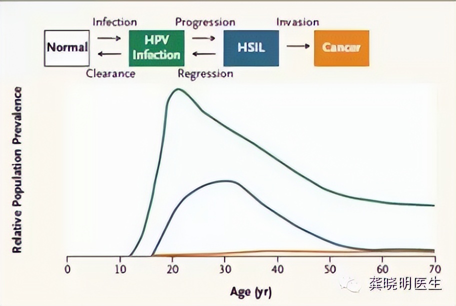HPV感染非常普遍吗,hpv感染没有病变严重吗