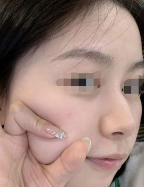 cemoy水乳孕妇可以用吗,后粉色水妍水乳孕妇可以用吗