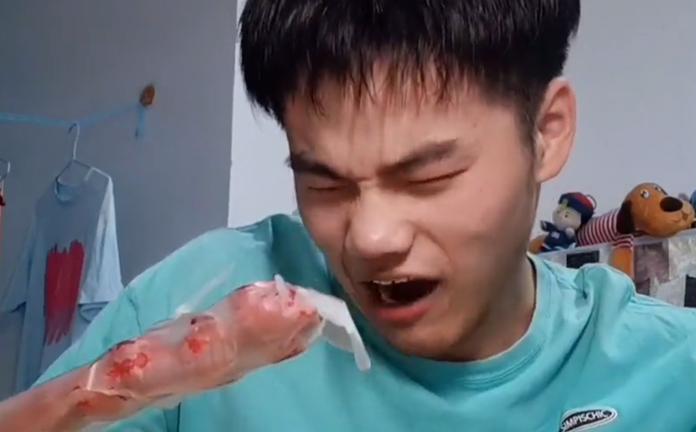 楠楠同学先天性脑瘫,楠楠同学抖音