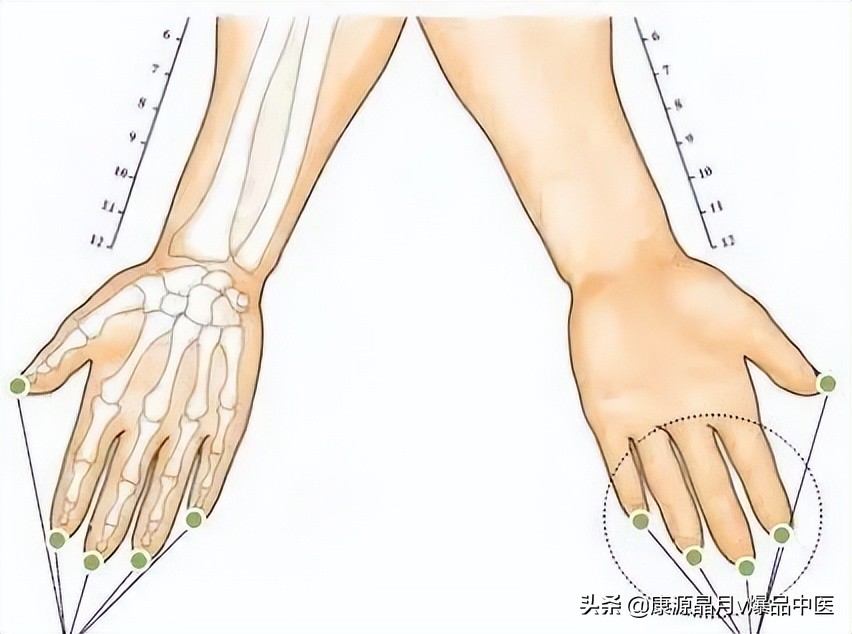 中医精华之人体特效穴,经外奇穴69个疑难杂症图解