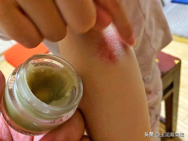 泰国青草膏被投诉到工商怎么处理,泰国卖青草膏