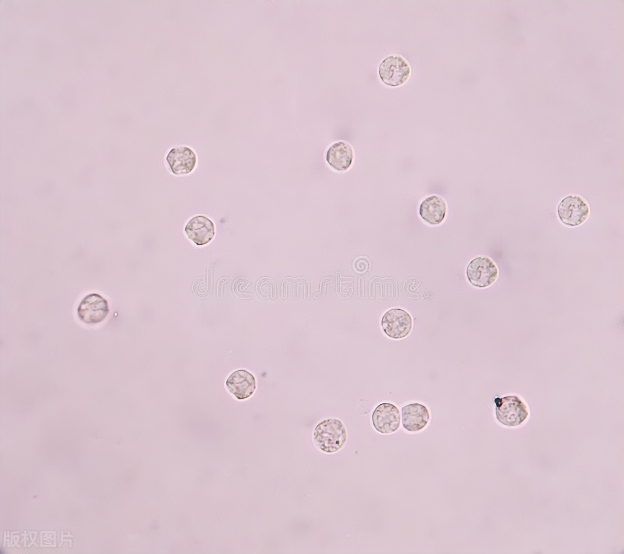 尿常规解读大全,教你看懂尿常规中的常用指标