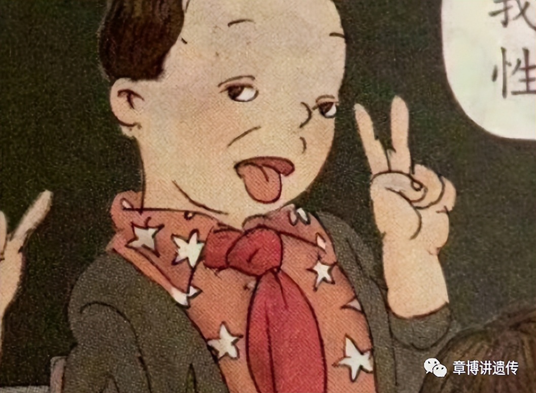 唐氏综合征的人相貌图片,唐氏综合征国字脸