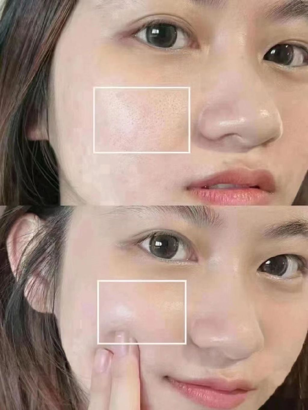 比较好的水光针有哪些,除了水光针还有什么美容手段